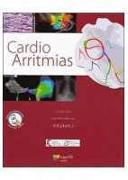 CARDIO ARRITMIAS (VOL.1)