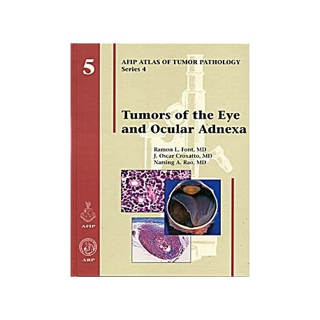 TUMORS OF THE EYE AND OCULAR ADNEXA Nº 5 SERIE-4