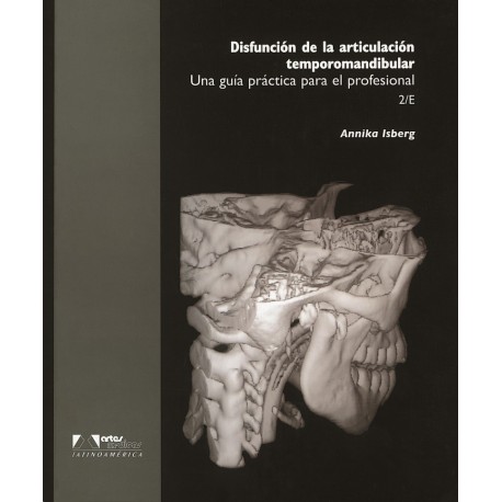 DISFUNCION DE LA ARTICULACION TEMPOROMANDIBULAR