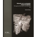 DISFUNCION DE LA ARTICULACION TEMPOROMANDIBULAR