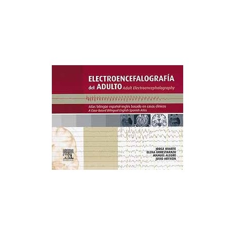ELECTROENCEFALOGRAFIA DEL ADULTO. ATLAS BILINGÜE ESPAÑOL-INGLES BASADO EN CASOS CLINICOS