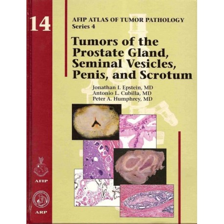 TUMORS OF THE PROSTATE GLAND, SEMINAL VESICLES, PENIS, AND SCROTUM: 14 (AFIP ATLAS OF TUMOR PATHOLOGY)
