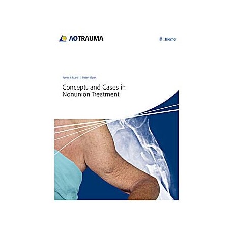 CONCEPTS AND CASES IN NONUNION TREATMENT