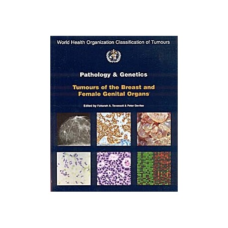 PATHOLOGY AND GENETICS TUMOURS OF THE BREAST & FEMALE GENITAL ORGANS