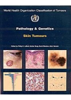 PATHOLOGY AND GENETICS OF SKIN TUMOURS
