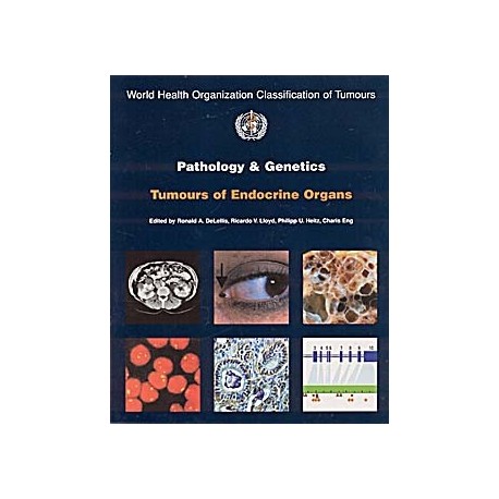 PATHOLOGY AND GENETICS OF TUMOURS OF ENDOCRINE ORGANS