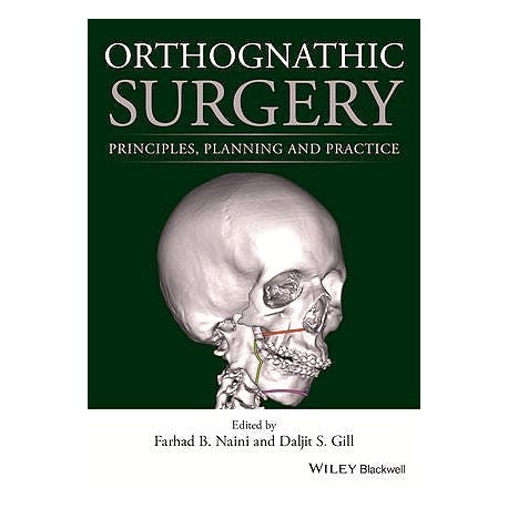 ORTOGNATHIC SURGERY. PRINCIPLES, PLANNING AND PRACTICE