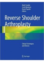 REVERSE SHOULDER ARTHROPLASTY