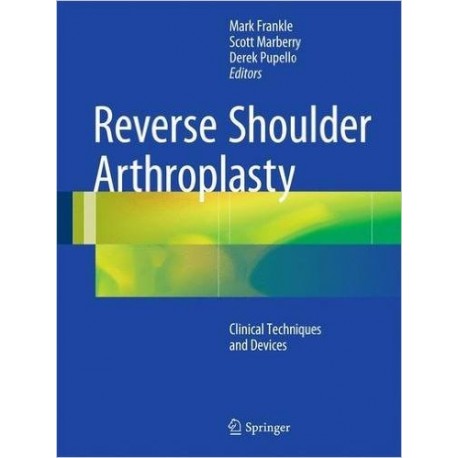 REVERSE SHOULDER ARTHROPLASTY
