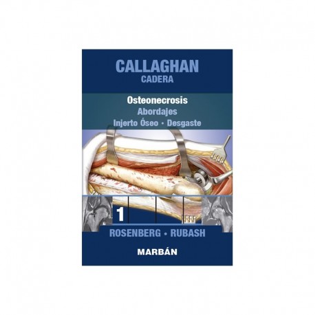 CADERA (TOMO 1) OSTEONECROSIS ABORDAJES INJERTO OSEO DESGASTE