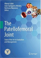 THE PATELLOFEMORAL JOINT. STATE OF THE ART IN EVALUATION AND MANAGEMENT