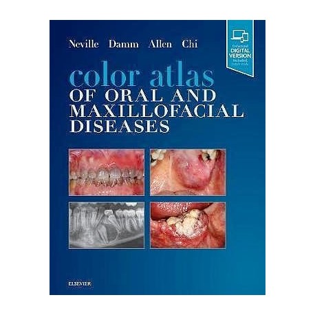 COLOR ATLAS OF ORAQL AND MAXILLOFACIAL DISEASES (PRINT AND ONLINE)