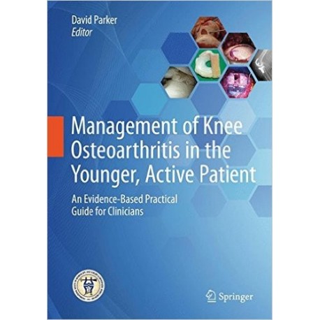 MANAGEMENT OF KNEE OSTEOARTHRITIS IN THE YOUNGER, ACTIVE PATIENT