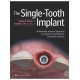 THE SINGLE-TOOTH IMPLANT