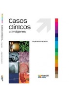 CASOS CLINICOS EN IMAGENES