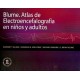 BLUME. ATLAS DE ELECTROENCEFALOGRAFIA EN NIÑOS Y ADULTOS