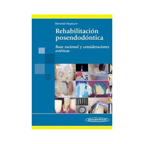 REHABILITACION POSENDODONTICA. BASE RACIONAL Y CONSIDERACIONES ESTETICAS