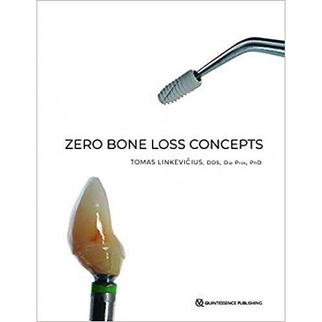 ZERO BONE LOSS CONCEPTS