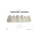LAMINATE VENEER 20 RECIPES FOR SMILE DESIGN