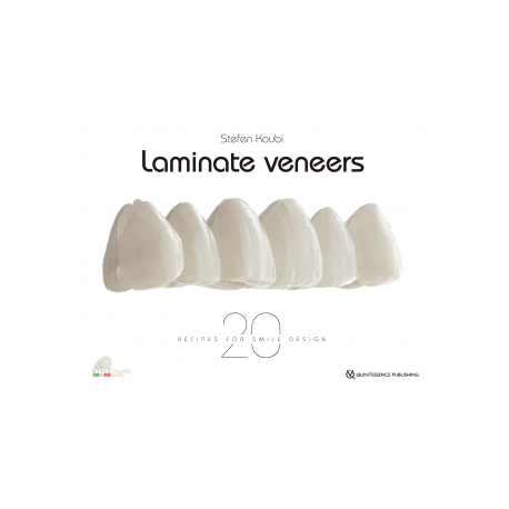 LAMINATE VENEER 20 RECIPES FOR SMILE DESIGN