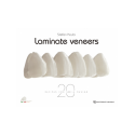 LAMINATE VENEER 20 RECIPES FOR SMILE DESIGN