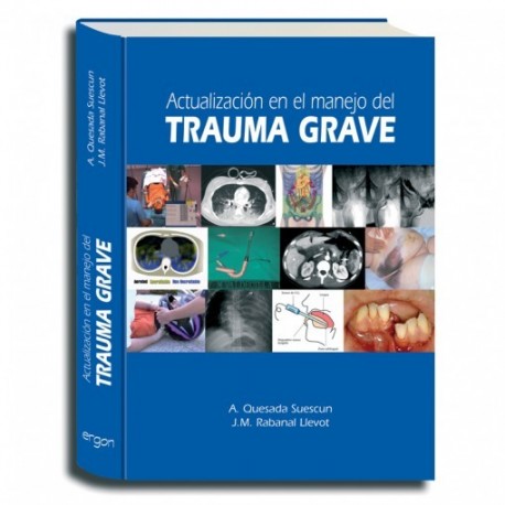 ACTUALIZACION EN EL MANEJO DEL TRAUMA GRAVE