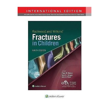 ROCKWOOD AND WILKINS FRACTURS IN CHILDREN