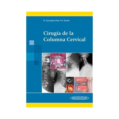 CIRUGIA DE LA COLUMNA CERVICAL