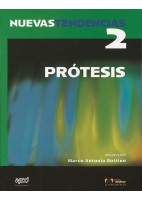 NUEVAS TENDENCIAS. VOLUMEN 2. PROTESIS