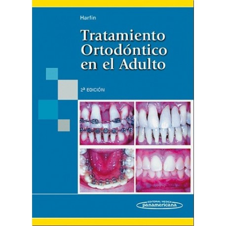 TRATAMIENTO ORTODONTICO EN EL ADULTO