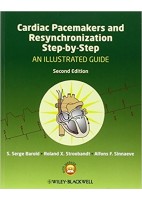CARDIAC PACEMAKERS AND RESYNCHRONIZATION STEP-BY-STEP