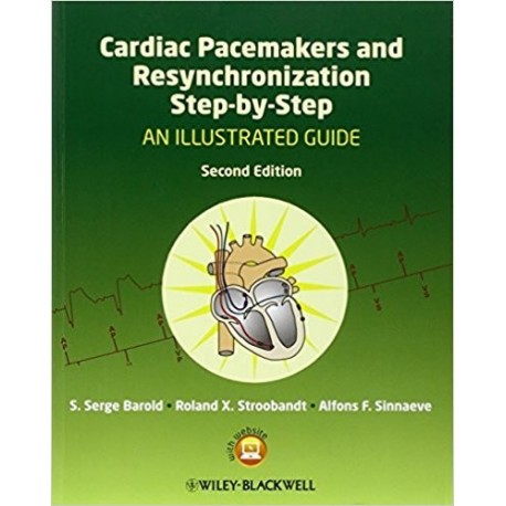 CARDIAC PACEMAKERS AND RESYNCHRONIZATION STEP-BY-STEP