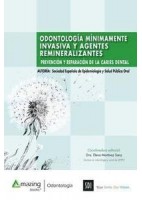 ODONTOLOGIA MINIMAMENTE IVASIVA Y AGENTES REMINERALIZANTES