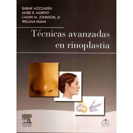 TECNICAS AVANZADAS EN RINOPLASTIA + STUDENT CONSULT EN ESPAÑOL