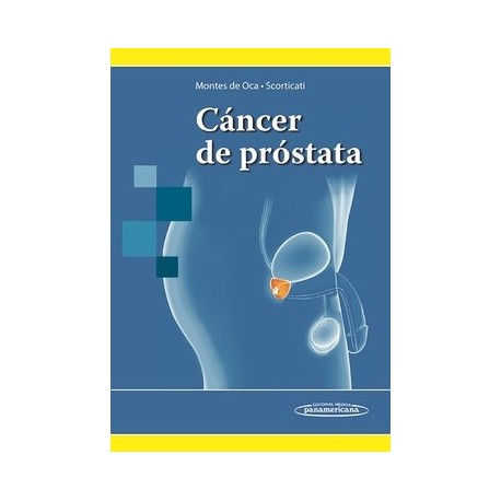 CANCER DE PROSTATA