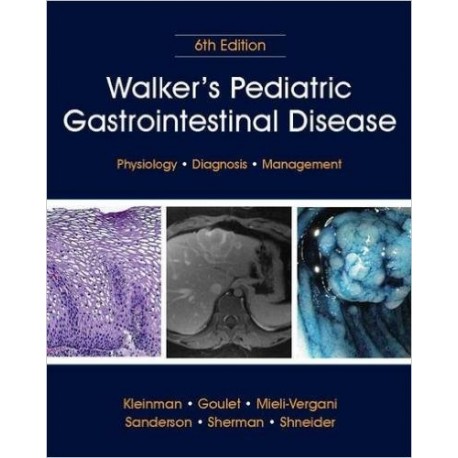 WALKER`S PEDIATRIC GASTROINTESTINAL DISEASE