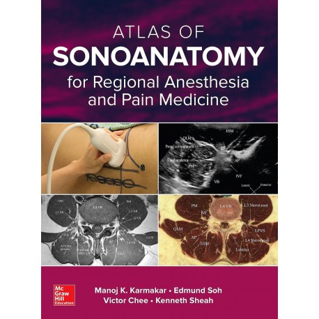 ATLAS OF SONOANATOMY FOR REGIONAL ANESTHESIA AND PAIN MEDICINE