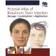 PICTORIAL ATLAS OF BOTULINUM TOXIN INJECTION
