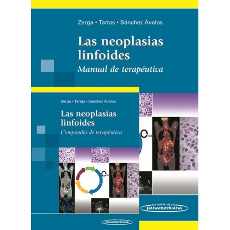 LAS NEOPLASIAS LINFOIDES: MANUAL DE TERAPEUTICA + COMPENDIO DE TERAPEUTICA