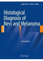 HISTOLOGICAL DIAGNOSIS OF NEVI AND MELANOMA