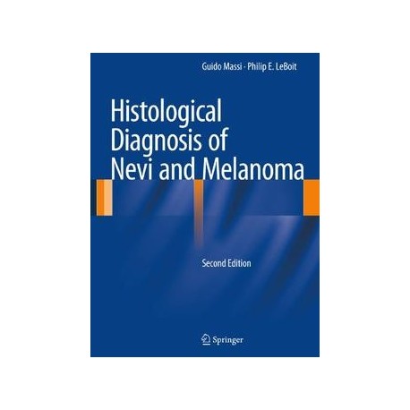 HISTOLOGICAL DIAGNOSIS OF NEVI AND MELANOMA
