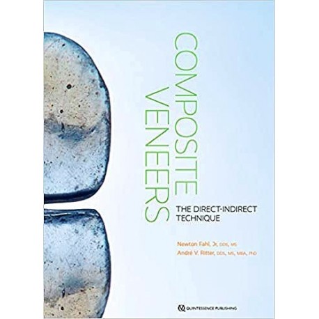 COMPOSITE VENEERS. THE DIRECT-INDIRECT TECHNIQUE