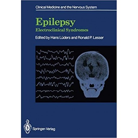 EPILEPSY. ELECTROCLINICAL SYNDROMES