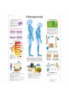 OSTEOPOROSIS (VR-3121)